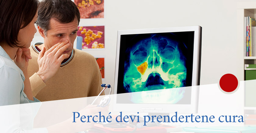 Quello che devi sapere sul tuo seno mascellare