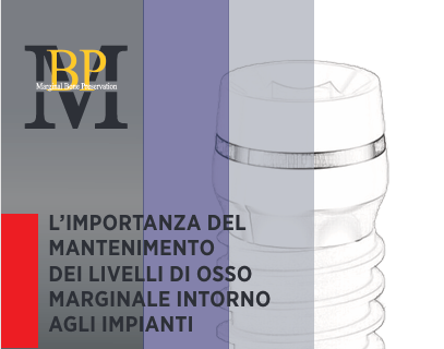 L’importanza del mantenimento dei livelli di osso marginale intorno agli impianti